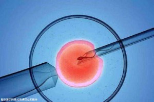 爱心供卵助孕咨询怎么收费试管婴儿中心